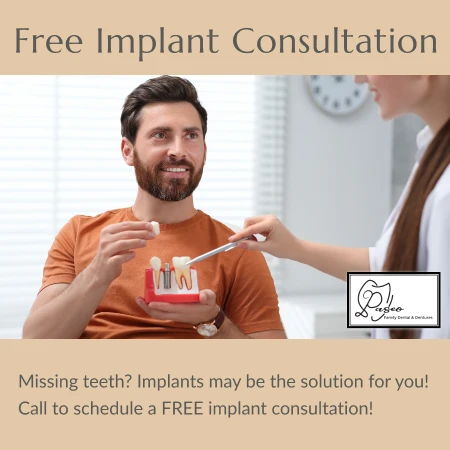 Implant Special